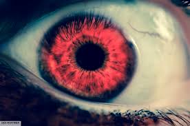 J AAPOS：先天性<font color="red">青光眼</font>患儿的<font color="red">青光眼</font>引流装置术后出现眼球突出症