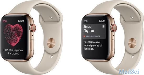 心脏病专家看新款苹果<font color="red">手表</font>：或引发焦虑和担忧