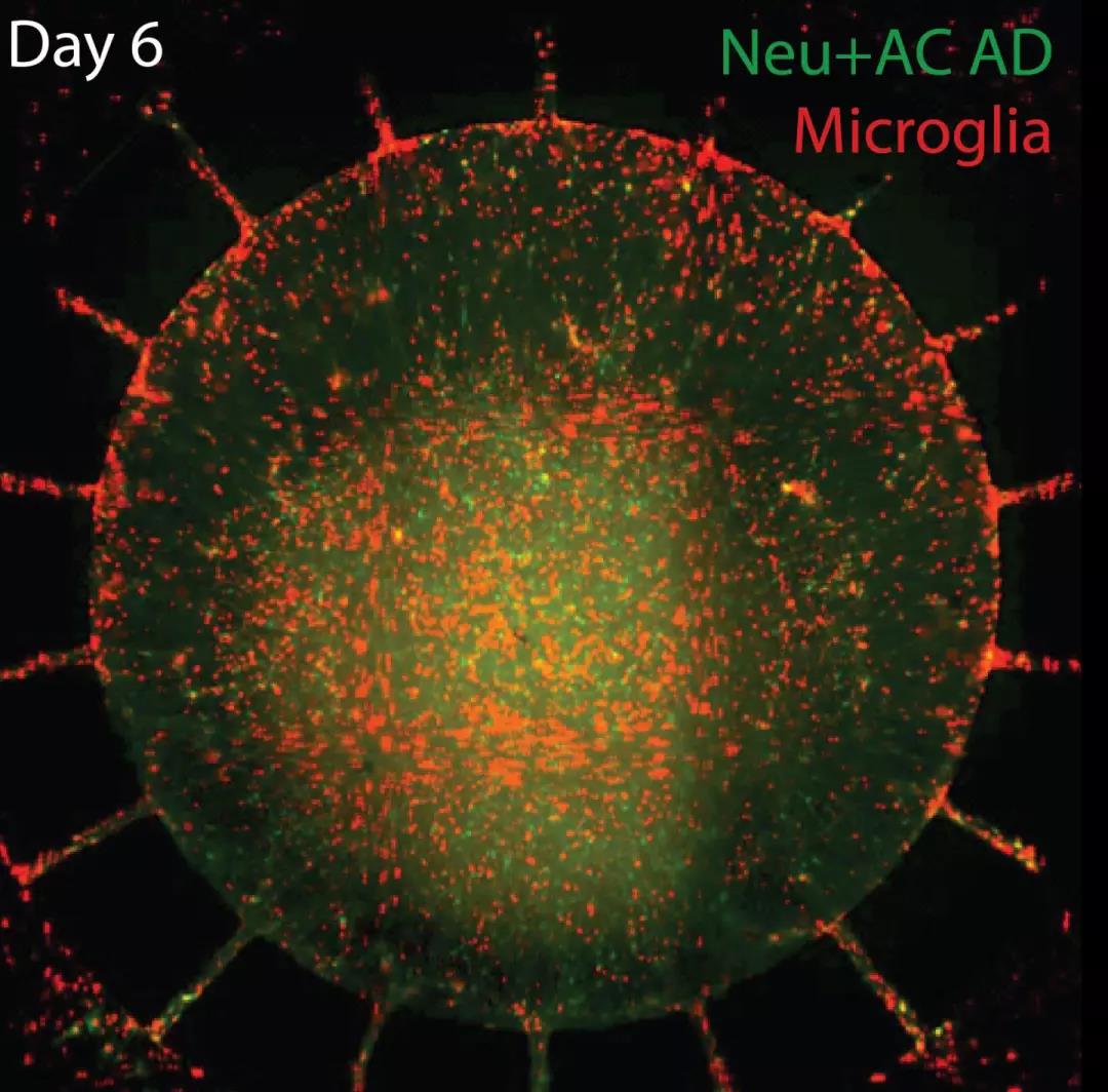 Nat Neurosci：携带神经炎症的阿尔兹海默症新模型