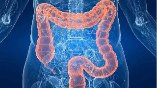 Clinical Gastroenterology H：炎症性<font color="red">肠</font>病会增加急性心肌梗死和心力<font color="red">衰竭</font>的风险