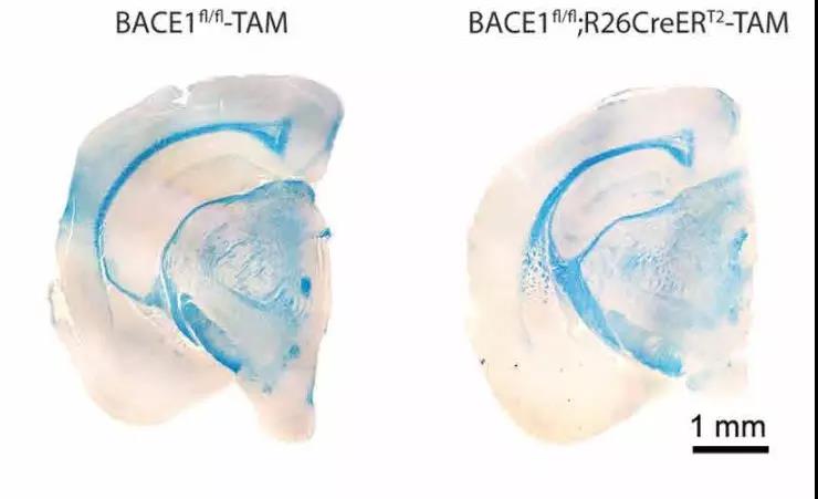 Sci Transl Med：阿尔茨海默药物研发阴云再起！科学家发现BACE1抑制剂可能存在严重认知损失副作用