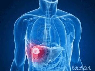 J Gastroenterology：肝细胞癌是日本2<font color="red">型</font>糖尿病患者中癌症相关死亡的主要原因