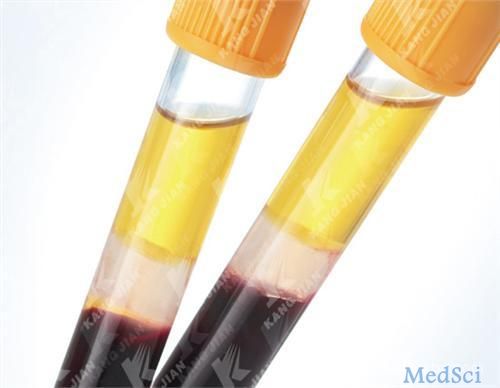 J Gastroenterology：高<font color="red">水平</font>的血清Mac-2结合蛋白糖基化异构体（M2BPGi）可以预测用核苷酸类似物<font color="red">治疗</font>的乙型肝炎患者肝细胞癌的发展