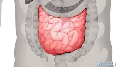 Gastroenterology：Ustekinumab诱导克罗恩病患者炎症缓解的疗效