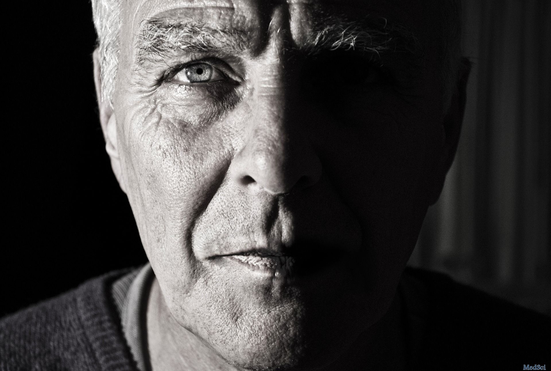 PNAS：为何腹股沟疝在老年男性中高发？