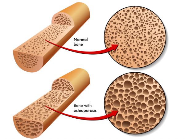 Cell Res：循环凋亡小体通过转移多种细胞因子维持间充质干细胞稳态并改善骨质减少