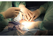 Prostate Cancer P D：经尿道切除外科手术持续的时间对前列腺癌的影响研究