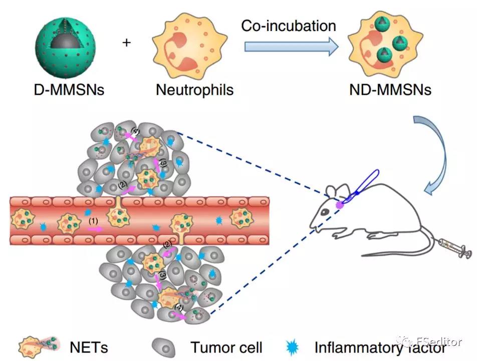 Nat Commun：深圳先进院在磁共振影像示踪细胞治疗脑胶质瘤研究中获进展