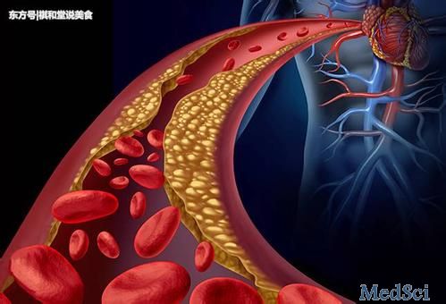 DDS： 简单血管<font color="red">结构</font>分类可以预测胰腺神经内分泌肿瘤分级和预后