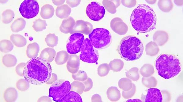 Sci Transl med:白血病患者福音！新发现有望提高“造血干细胞移植”成功率