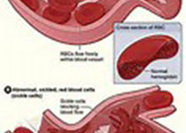 Heart：维生素K和<font color="red">血管</font>疾病