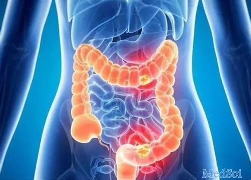 Gastroenterology：布地奈德与美沙拉嗪或安慰剂作为淋巴细胞性结肠炎的诱导治疗的疗效和安全性分析