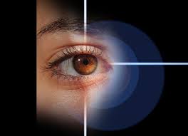 Eye：从实验基础和经济因素等综合考虑对急性原发性闭角症的治疗策略