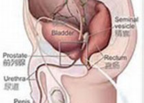 超声引导下经直肠前列腺穿刺安全共识