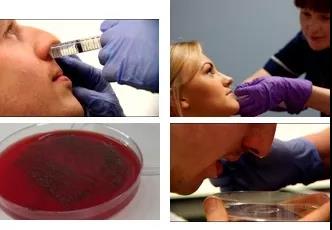 Nat Immunol：从流感到肺炎<font color="red">人体</font>研究回答两者的细胞机制关联