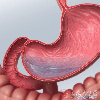Clin Gastroenterology H： T1期食管鳞状细胞癌内镜黏膜下剥离与食管切除术的疗效比较
