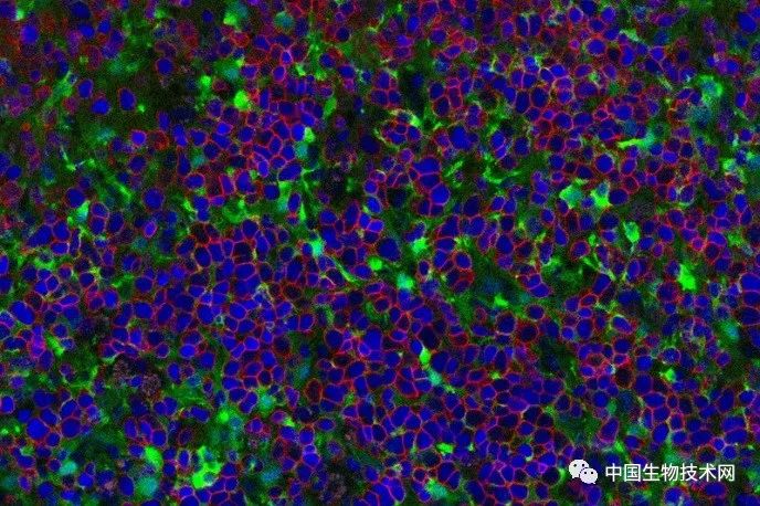 Cell Stem Cell：无限供应：对<font color="red">抗癌症</font>的可再生T细胞