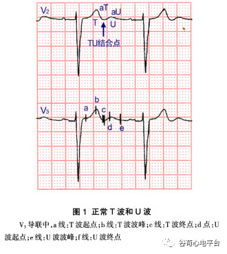 心电图出现了TU融合，应该如何诊断？