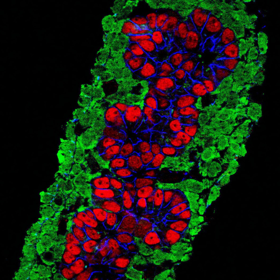 <font color="red">高血糖</font>会导致每个β细胞每秒泄漏10万个ATP分子，胰岛细胞就是这样被活活饿死的