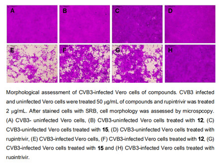 J Nat Prod：对柯萨奇B3病毒CVB3和人鼻病毒HRV1B有抑制作用的<font color="red">木</font><font color="red">脂</font><font color="red">素</font>类化合物