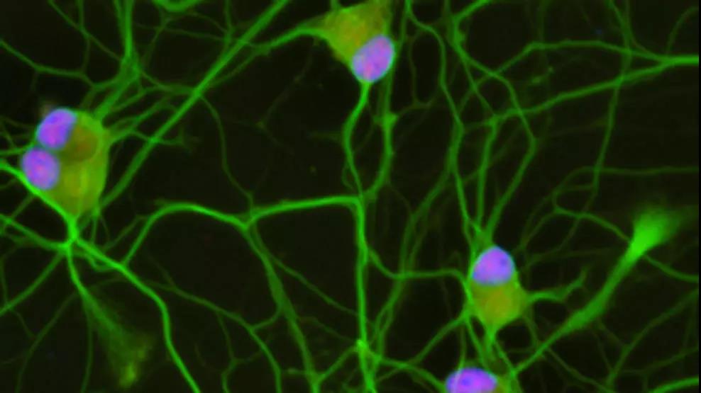 Nat Neurosci：哈佛大学揭示“渐冻症”（ALS）的潜在治疗靶标