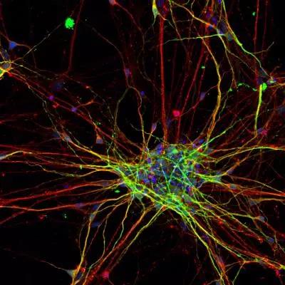 Nat Neurosci：自闭症神经元生长更快，分支更复杂