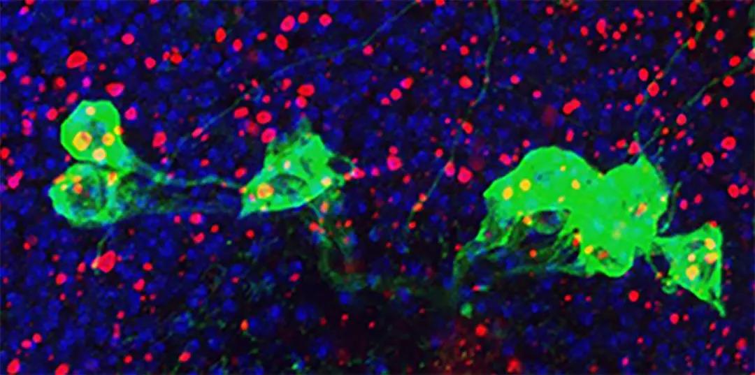 Cell Rep：NIH研究表明，高活性免疫与衰老性脑疾病有关