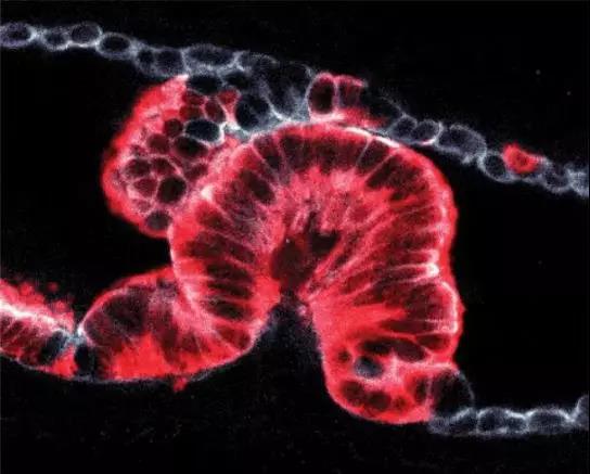 Nature:组织活检与3D技术两开花，揭秘癌症之王起源！