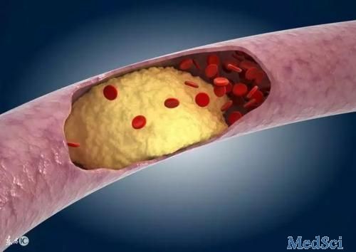 J Gastroenterology：冠状动脉斑块形态学中肝脏脂肪变性的临床意义