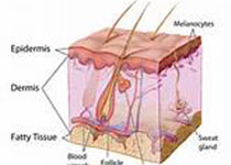 美国皮肤病学会AAD发布：富含血小板的血浆疗法可有效治疗雄激素性脱发