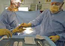 JAMA Surg：退伍军人事务部肺癌视频辅助胸腔镜肺切除术的使用