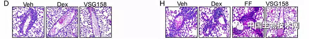 PNAS：科学家发现能逆转激素耐受型哮喘的新型糖皮质激素<font color="red">配体</font>药物
