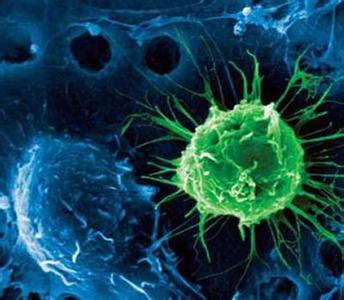 Nat Med：新研究称肠道细菌检测可用于预测结肠直肠癌