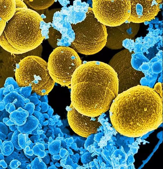 Microbiome：金<font color="red">黄色</font>葡萄球菌产物引发自身性免疫
