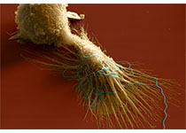 Nat Commun：食管鳞状细胞癌治疗新的见解