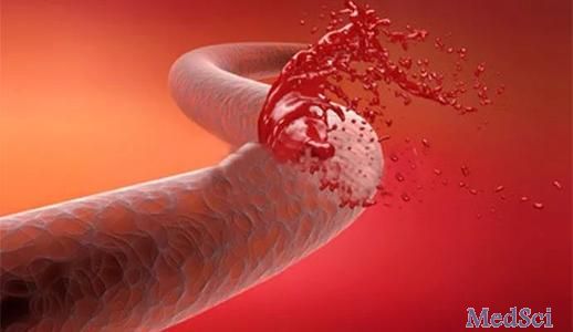 GUT：食管胃底<font color="red">静脉曲张出血</font>后早期使用止血粉的疗效分析