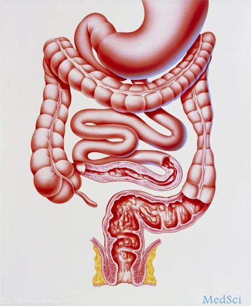 BMC Gastroenterology：<font color="red">炎症性</font>肠病经常出现的肝胆和胰腺症状分析