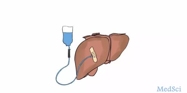 Hepatology：低血清铁调节蛋白与急性肝衰竭患者短期存活率降低有关