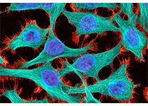 PNAS：人类B淋巴细胞的突变数量随着年龄增长而增加
