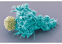 Nat Commun：肺癌与免疫系统还有这层关系？