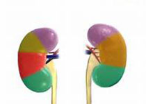 KIDNEY INT：透析前<font color="red">慢性</font><font color="red">肾病患者</font>死亡风险增加与铁异常相关
