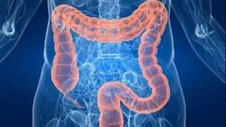 Dig Liver Dis： 生物制剂使用时小肠克罗恩病狭窄成形术后早期复发的影响因素