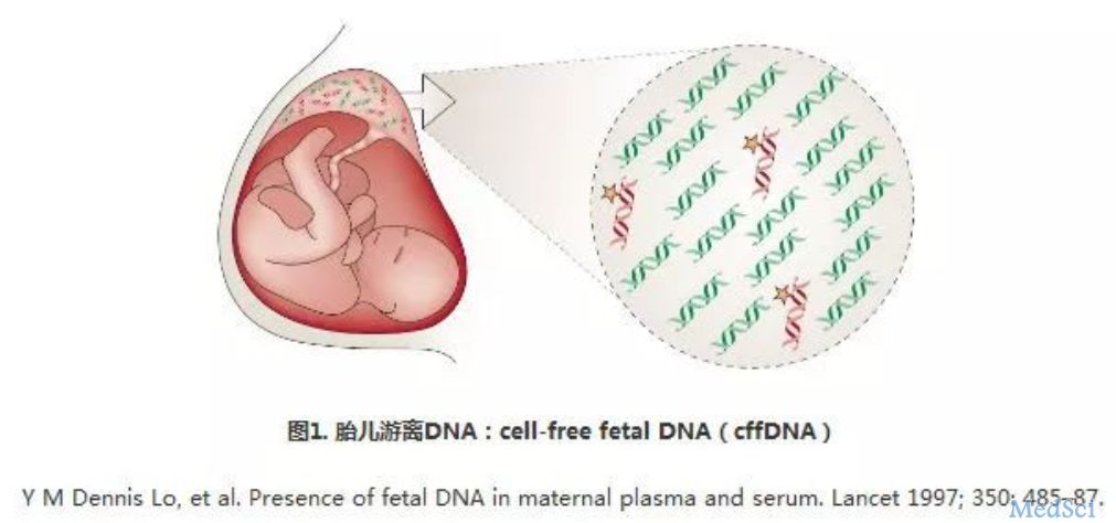 利用cfDNA检测21三体在双胎和单胎中结果相似 NIPT检测范围进一步扩大