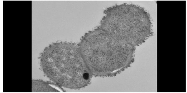 PNAS：首次！肠菌在克罗恩病中作用的分子机制