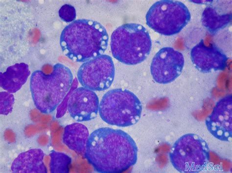 B细胞淋巴瘤治疗：即使CAR-T疗法失败，还有双特异性抗体<font color="red">REGN</font>1979