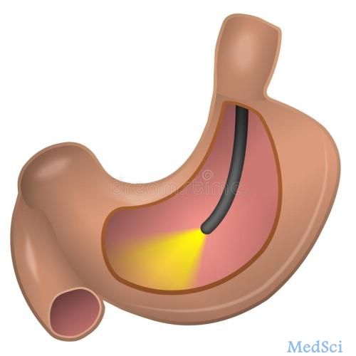 BMC Gastroenterology：内镜扩张在治疗难治性良性食管狭窄中的作用
