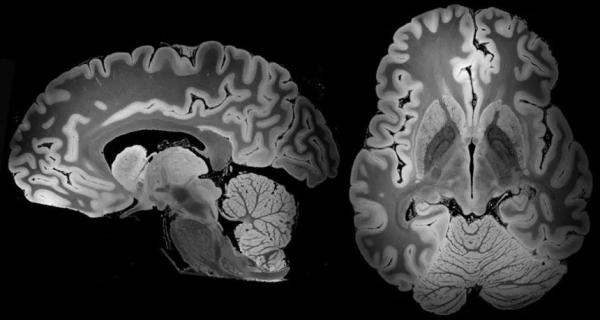 强大MRI技术持续扫描100小时，迄今最详细人脑图像出炉