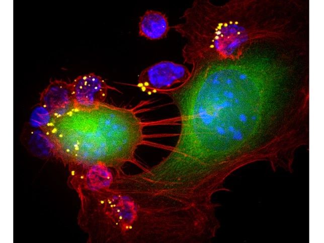 Science：MIT科学家发明两亲疫苗，大幅提高CAR-T抗癌活性，将60%小鼠肿瘤完全清除