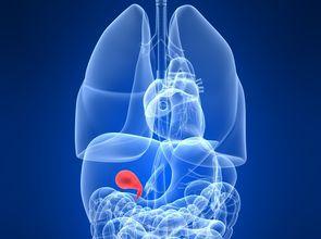 Hepatology：血清金属水平与胆结石和胆囊癌发生关系