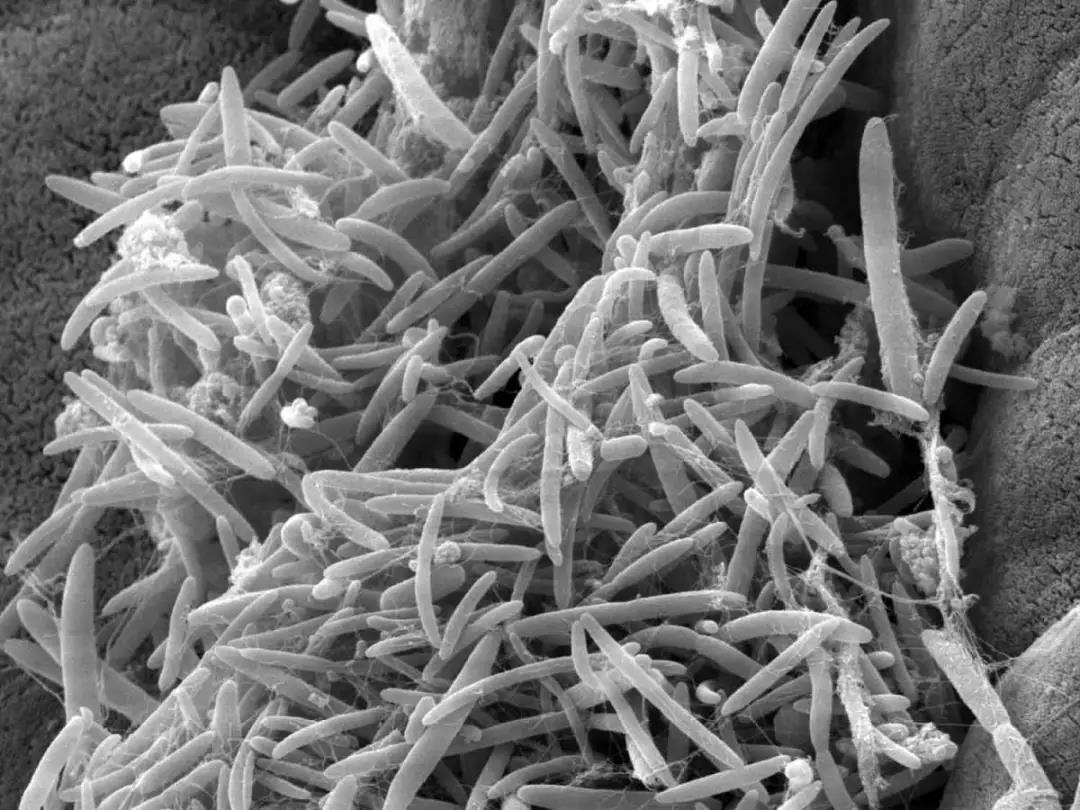 Nature：肠道细菌浑身是宝，其分泌物可延缓ALS病程
